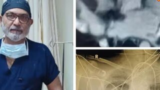 সফল অস্ত্রোপচার করে জীবনদান করলেন ডাক্তার প্রশান্ত বৈদ্যনাথ