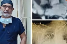 এক ব্যক্তির দু'টি হৃদপিণ্ড! সফল অস্ত্রোপচারে জীবনদান চিকিৎসকদের, ঘটনা জানলে অবাক