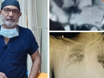 সফল অস্ত্রোপচার করে জীবনদান করলেন ডাক্তার প্রশান্ত বৈদ্যনাথ