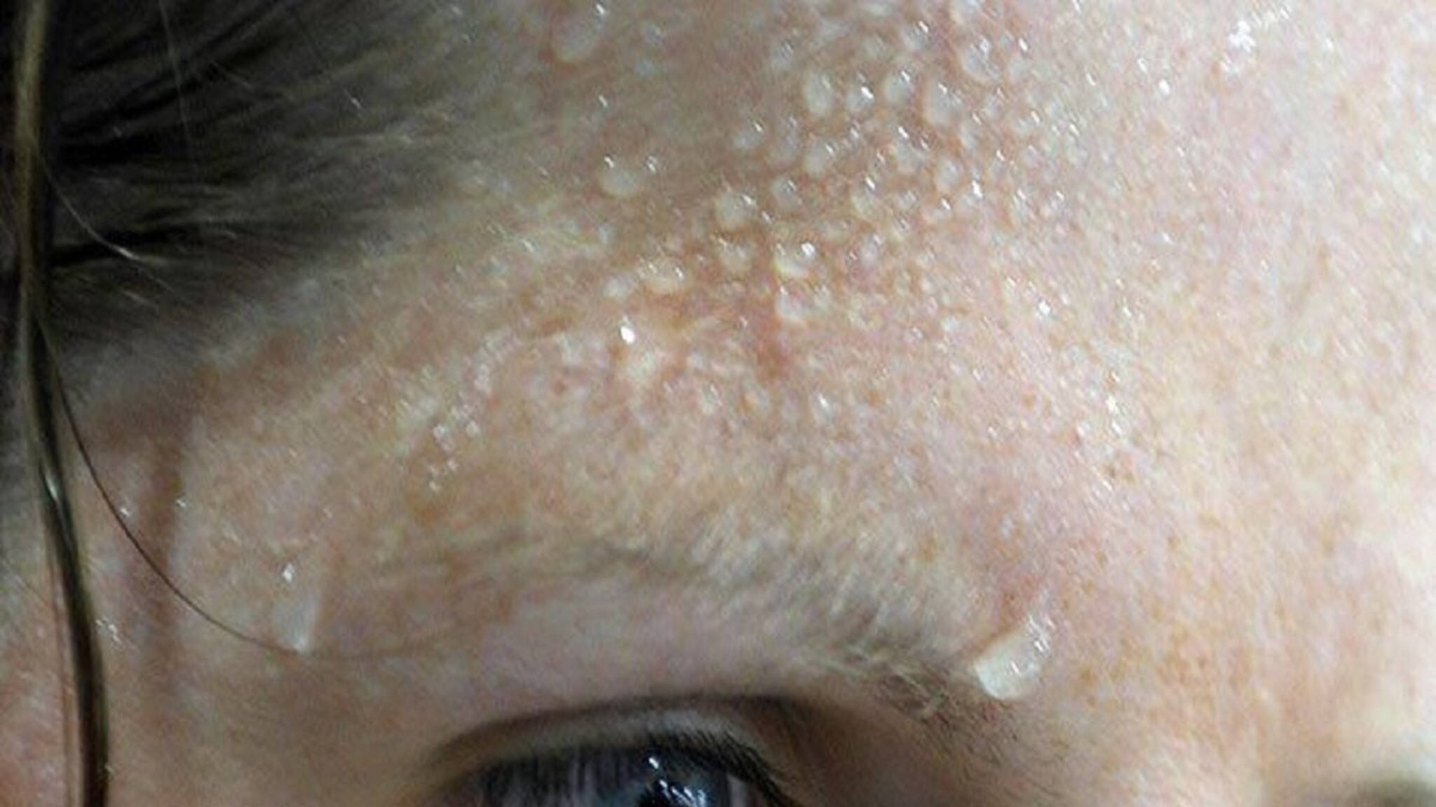 গরমে অতিরিক্ত ঘামেন? এই সহজ ঘরোয়া উপায়ে মিলবে মুক্তি