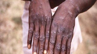 পাকিস্তানে ভাইরাস হানা