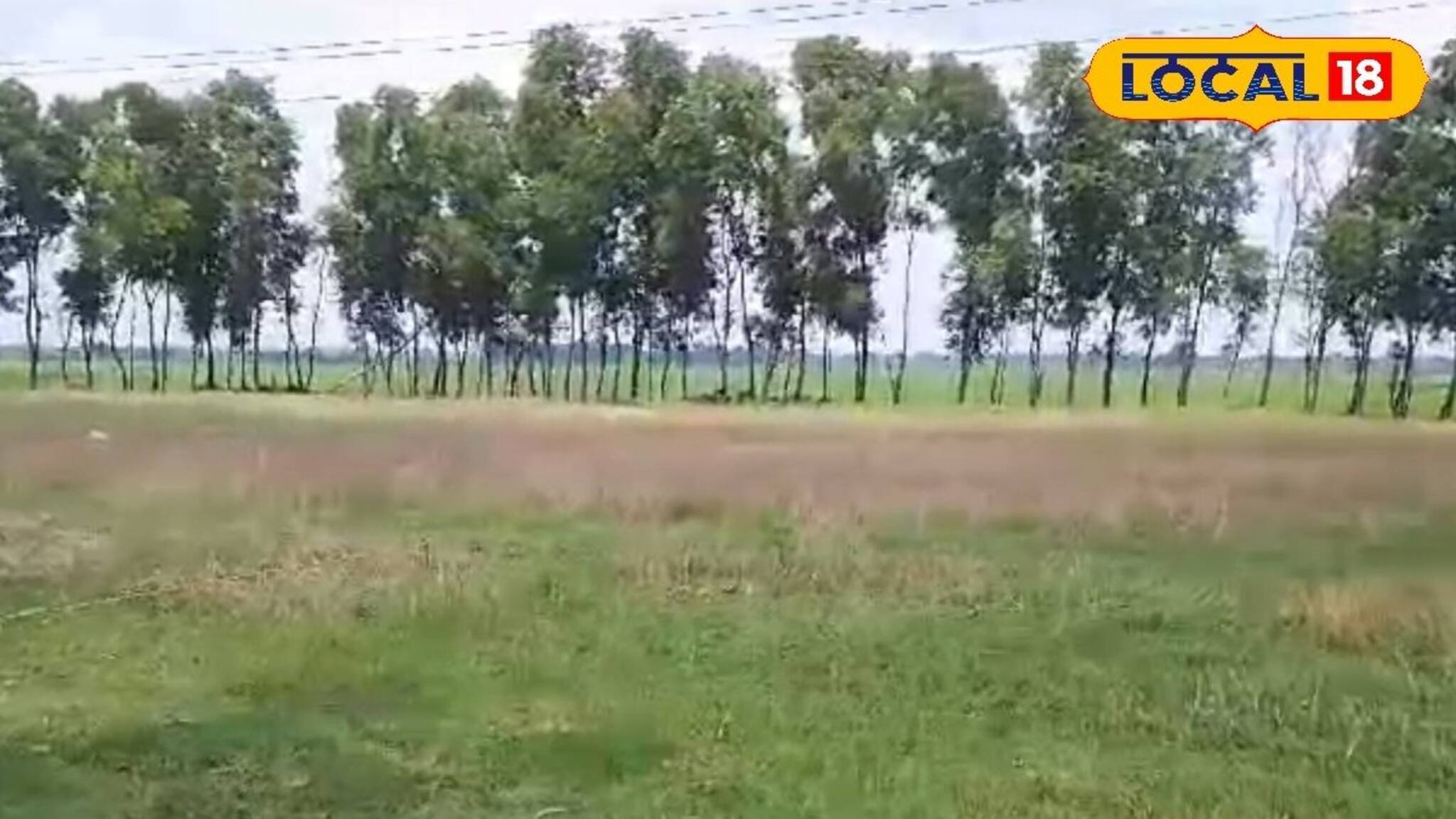 বিদ্যুতের তার কেড়ে নিয়েছিল শৈশব! অবশেষে যা হল...