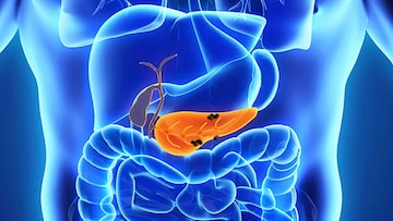 প্যানক্রিয়াটাইটিস মোকাবিলায় কী কী খাবেন, কী কী খাবেন না, পড়ুন প্যানক্রিয়াটাইটিস মোকাবিলায় কী কী খাবেন, কী কী খাবেন না, পড়ুন