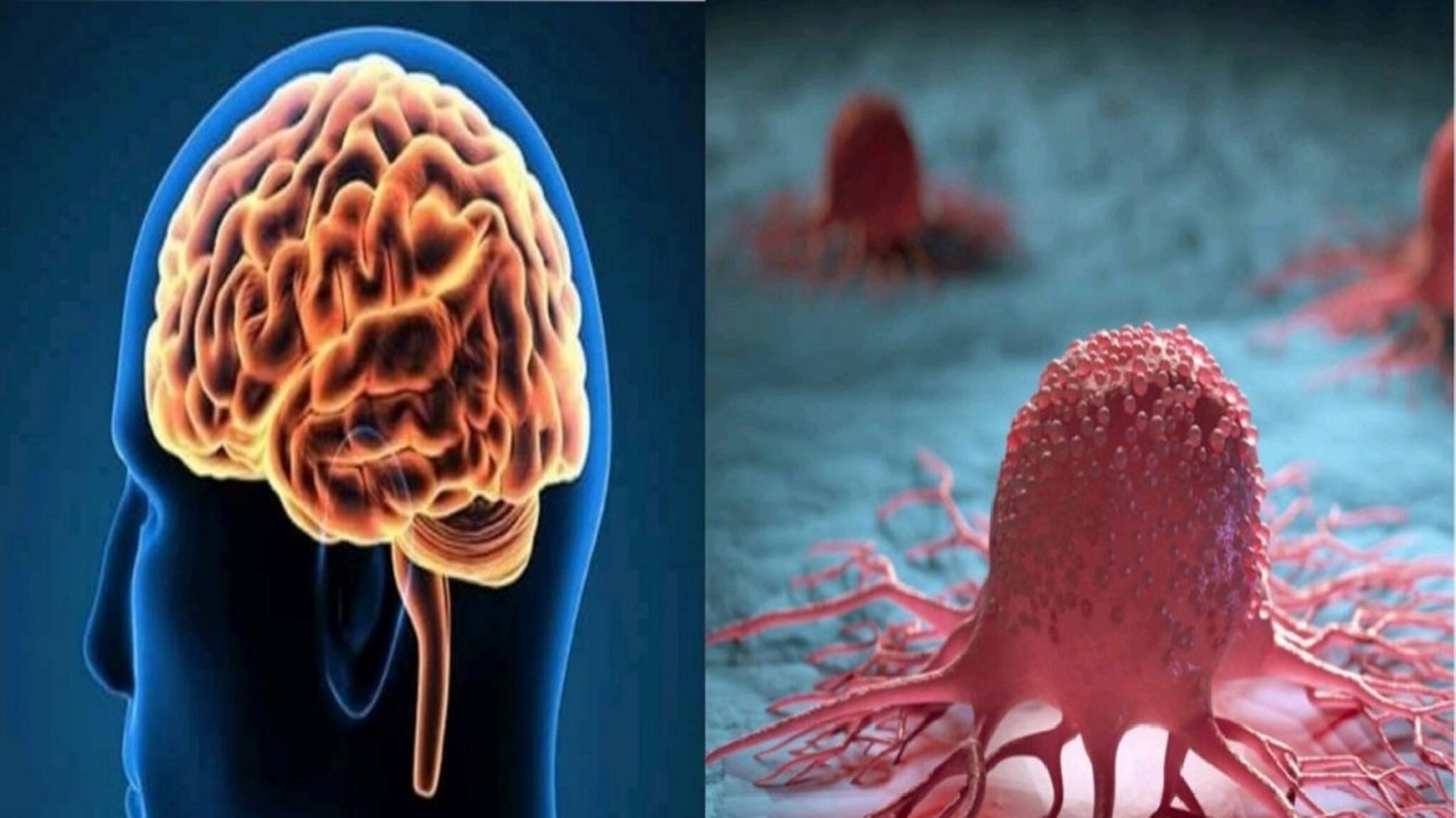 স্টিল-কাচ নয়, নিয়মিত এভাবে জলপানে দ্বিগুন উপকার! কমে ক্যানসার, সেরিব্রালের ঝুঁকি