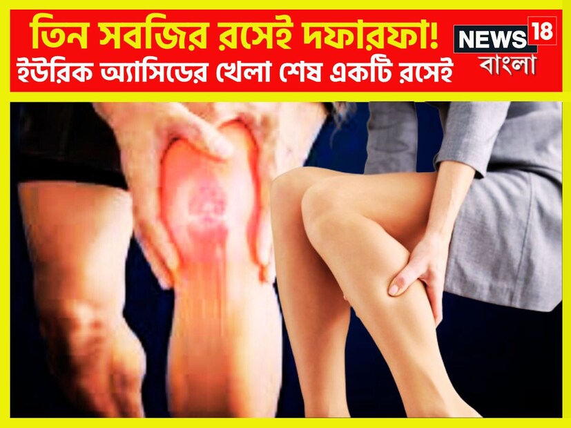 বর্তমানে ইউরিক অ্যাসিডের সমস্যায় জেরবার বহু মানুষ ৷ প্রধানত ইউরিক অ্যাসিড বাসা বাঁধে কয়েকটি কারণের জন্য যেমন খারাপ জীবনশৈলী, বিশ্রামের অভাবের সঙ্গে সঙ্গে খারাপ বা নিম্ন মানের খাবার দায়ী এর জন্য ৷ প্রতীকী ছবি ৷ বর্তমানে ইউরিক অ্যাসিডের সমস্যায় জেরবার বহু মানুষ ৷ প্রধানত ইউরিক অ্যাসিড বাসা বাঁধে কয়েকটি কারণের জন্য যেমন খারাপ জীবনশৈলী, বিশ্রামের অভাবের সঙ্গে সঙ্গে খারাপ বা নিম্ন মানের খাবার দায়ী এর জন্য ৷ প্রতীকী ছবি ৷