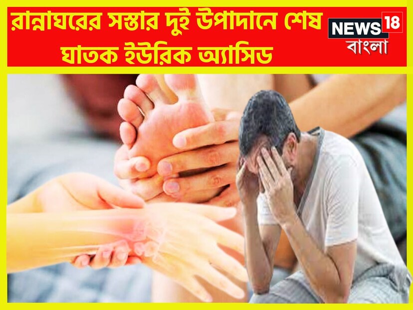 শরীরে ইউরিক অ্যাসিডের বাড় বাড়ন্ত হলেন তা খুব তাড়াতাড়ি আয়ত্তে আনতে হয় ৷ কেননা যখনই ইউরিক অ্যাসিডের স্তর রক্তে বাড়তে থাকে ৷ প্রতীকী ছবি ৷