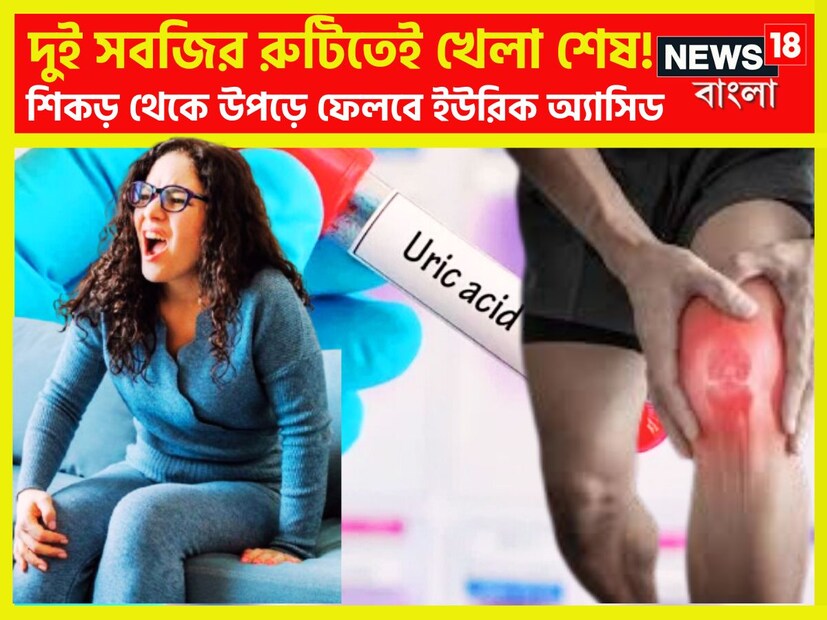 ইউরিক অ্যাসিডের পরিমাণ সীমানা ছাড়ালেই বিপদ দেখা দেয় ৷ প্রতিটি মানুষেরই শরীরে ইউরিক অ্যাসিড নির্দিষ্ট পরিমাণে থাকে ৷ প্রতীকী ছবি ৷