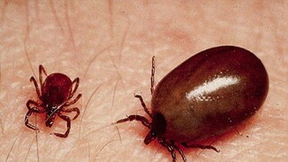 Scrub Typhus Scrub Typhus