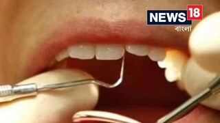 একদিনে ২৩ দাঁত তুলে প্রাণ হারালেন ব্যক্তি