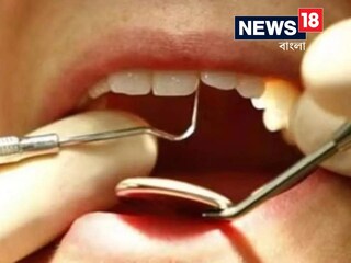 একদিনে ২৩ দাঁত তুলে প্রাণ হারালেন ব্যক্তি