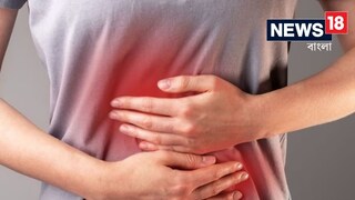 ডিসুরিয়া আক্রান্ত হলে কী কী করবেন জানুন