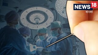 অবাক কাণ্ড! রোগীর পেটের ভিতরে ফুটেছিল অজস্র পিন! অস্ত্রোপচার করতেই হতবাক চিকিৎসক....