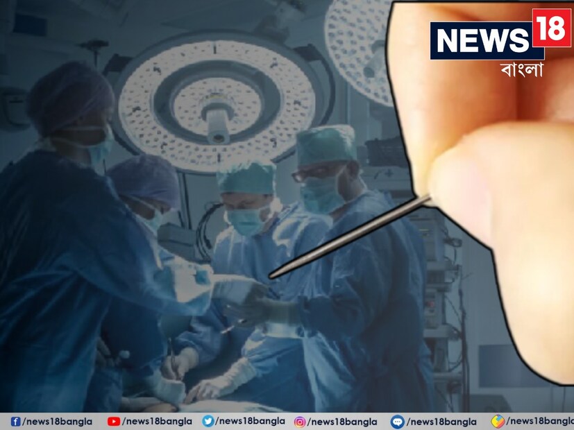 সূঁচ: বিনামূল্যে কেনা সুই ব্যবহার করা দাম্পত্য জীবন ও প্রেমের সম্পর্কের ওপর খারাপ প্রভাব ফেলে। বিনামূল্যে সূঁচ আর্থিক ক্ষতিও করে। অতএব, আপনার যদি এটির প্রয়োজন হয় তবে আপনার নিজের সূঁচ কিনে ব্যবহার করা উচিত। বাস্তুশাস্ত্র অনুসারে, বিনামূল্যে একটি সূঁচ পেলে জীবনে নেতিবাচকতা আসে। 