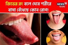 আপনি কি অসুস্থ? জিভের রং বলে দেবে শরীরে বাসা বেঁধেছে কোন রোগ!...রং মিলিয়ে দেখুন