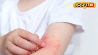 ত্বকের যত্ন কীভাবে?