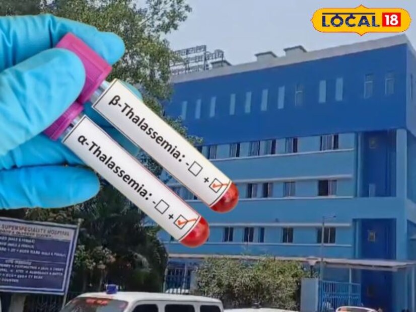তিনি বলছেন, যারা বিবাহবন্ধনে আবদ্ধ হবেন, তারা যদি থ্যালাসেমিয়া মেজরের বাহক না হন, তাহলে তাদের সন্তানের থ্যালাসেমিয়া আক্রান্ত হওয়ার সম্ভাবনা নেই বললেই চলে। কিন্তু যদি তারা যদি থ্যালাসেমিয়া মেজর বাহক হন, তাহলে আগামী প্রজন্মের থ্যালাসেমিয়া আক্রান্ত হওয়ার সম্ভাবনা অনেক বেড়ে যায়। তিনি আরও জানিয়েছেন, বর্তমানে অনেক দেশে থ্যালাসেমিয়া আক্রান্ত রোগীদের বিবাহে অনেক বিধি নিষেধ আরোপ করা হয়েছে। তবে ভারতবর্ষে সেই নিয়ম সম্ভব নয়।