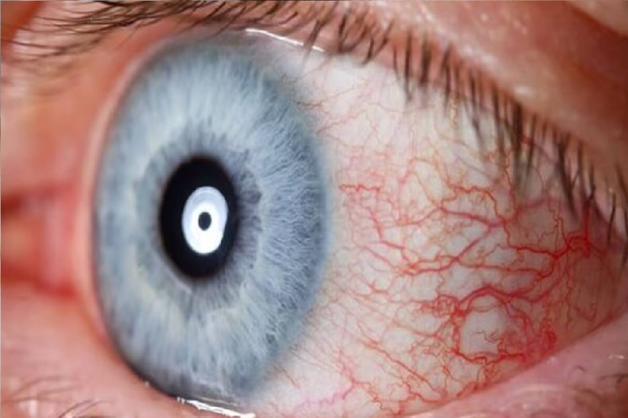 চোখেও স্ট্রোক হয়, কখনও শুনেছেন? দৃষ্টিশক্তি হারানোর ভয় থেকে বাঁচুন, উপসর্গ চিনুন