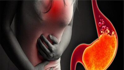 পাচনতন্ত্রকে শক্তিশালী করার জন্য শিলা লবণ অত্যন্ত উপকারী। এতে উপস্থিত প্রাকৃতিক খনিজ পদার্থ হজমশক্তি উন্নত করে এবং অন্ত্র পরিষ্কার করতে সাহায্য করে। এটি গ্রহণ করলে অন্ত্রে জমে থাকা বিষাক্ত পদার্থ বের হয়ে যায়, যার ফলে পেট হালকা বোধ হয়। এটি পাচক এনজাইমগুলিকে সক্রিয় করে, সহজে হজম হয় এবং ক্ষুধা বাড়ায়। শিলা লবণ বিশেষ করে তাদের জন্য উপকারী হতে পারে যারা ঘন ঘন পেট ফাঁপা, গ্যাস, বদহজম বা অ্যাসিডিটির সমস্যায় ভোগেন। হালকা গরম জলের সাথে অল্প পরিমাণে মিশিয়ে পান করলে গ্যাস এবং কোষ্ঠকাঠিন্য থেকে মুক্তি পাওয়া যায়। এটি পেট ফাঁপা কমায় এবং মলত্যাগ সহজ করে।