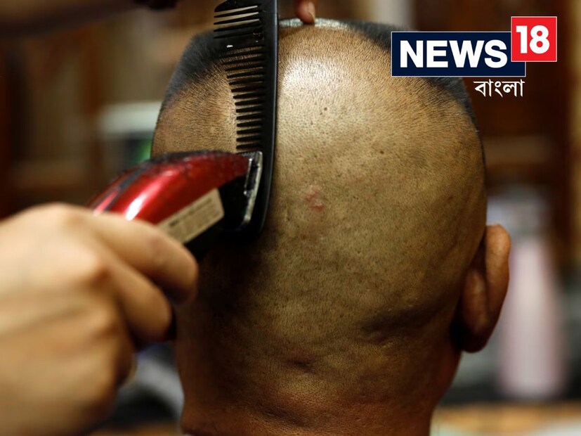উত্তর প্রদেশের কানপুরের জিএসভিএম মেডিকেল কলেজের ডার্মাটোলজিস্ট ড. যুগল রাজপুত নিউজ18-কে জানিয়েছেন যে বেশি চাপ চুলের জন্য ক্ষতিকর। যদিও চাপের প্রভাব পুরো শরীরে পড়ে, তবে এতে চুল পড়ার সমস্যা বাড়তে পারে। যখন আমরা চাপের মধ্যে থাকি, তখন শরীরে চাপের হরমোন হিসাবে পরিচিত করটিসলের মাত্রা বেড়ে যায়। এই হরমোনটি চুলের বৃদ্ধি প্রভাবিত করে এবং চুল পড়ার হার বাড়িয়ে দেয়। চাপের কারণে শরীরে ইনফ্লামেশনও বেড়ে যায়, যা গঞ্জাপনার কারণ হতে পারে। চুলকে স্বাস্থ্যকর রাখতে চাপ নিয়ন্ত্রণ করা অত্যন্ত জরুরি।