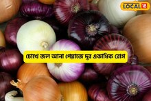 ত্রিফলা অস্ত্র!চোখে জল আনা পেঁয়াজের গুণ! একটাই কুপোকাৎ সুগার-প্রেশার-কোলেস্টেরল