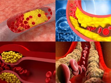 ৫ খাবারের পঞ্চবাণ! শিকড় থেকে উপড়ে ফেলবে খারাপ কোলেস্টেরলকে! কমবে হৃদরোগ-ভয়ও ৫ খাবারের পঞ্চবাণ! শিকড় থেকে উপড়ে ফেলবে খারাপ কোলেস্টেরলকে! কমবে হৃদরোগ-ভয়ও