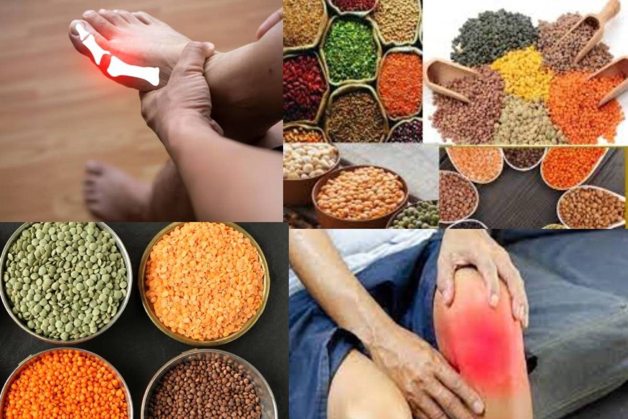 ইউরিক অ্যাসিডের ব্যথায় কেঁদে ফেলছেন? এখনই এই ডালগুলি খাওয়া ছাড়ুন! মুক্তি মিলবে