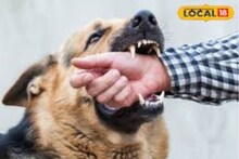 Dog bite remedies: কুকুরের কামড়ে রক্তাক্ত হয়েছেন? আতঙ্কিত না হয়ে কী করবেন? বিশেষজ্ঞের পরামর্শ জানুন