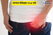 পাইলসে ছুটির দরখাস্ত,প্রমাণ চাইলেন ম্যানেজার,পশ্চাদ্দেশের ছবি তুলে পাঠালেন কর্মী