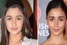 মুখে Botox করাতে গিয়ে বড় 'গোলমাল'? ঘোর বিতর্কে আলিয়া...! কী বললেন নায়িকা?