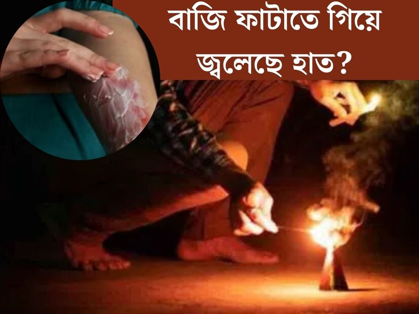 দীপাবলীতে আলোর উত্‍সবে মেতে উঠেছে গোটা দেশ। প্রদীপ, মোমবাতি থেকে আধুনিক টুনি বাল্বের জৌলুসে চেনা বাড়িগুলিকেই চেনা দায়। তবে দীপাবলিতে আলো জ্বালাবার পাশাপাশি বাজি ফাটাতেও অনেকেই পছন্দ করেন। 