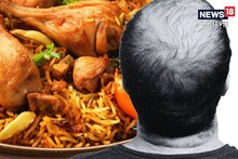 মুঠো-মুঠো চুল উঠে মাথা জুড়ে টাক, বিরিয়ানির হাঁড়িতেই লুকিয়ে আছে সমাধান