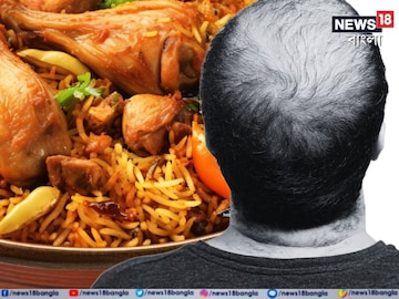 মুঠো-মুঠো চুল উঠে মাথা জুড়ে টাক, বিরিয়ানির হাঁড়িতেই লুকিয়ে আছে সমাধান