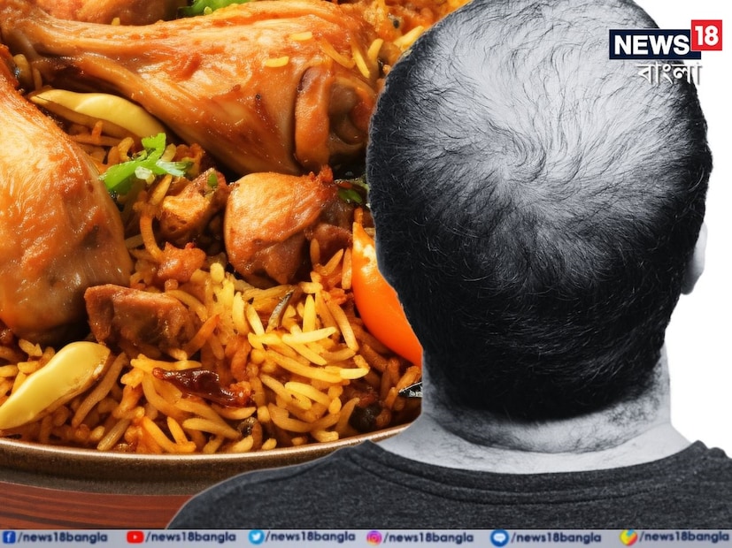 বিরিয়ানিতে এই মশলা অপরিহার্য৷ বিরিয়ানিতে ছোট এলাচ, দারচিনি, লবঙ্গে সঙ্গে আরও এক মশলা, যা ছাড়া এর স্বাদ পাওয়া প্রায় যায় না, তা হল স্টার অ্যানিস৷