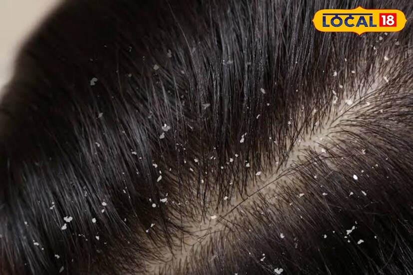 চুল ভাল রাখতে আর একটি ভীষণ কার্যকরী উপাদান হল মেথি। সারারাত জলে ভিজিয়ে রেখে সকালে ছেঁকে নিয়ে ভাল করে বেটে নিন। ছেঁকে নেওয়া জল ফেলে দেবেন না। এবার বেটে মেথি চুলের গোঁড়ায় মাথার ত্বকে ভাল করে লাগিয়ে নিন।ঘণ্টা খানেক রেখে চুল ভাল করে ধুয়ে ফেলুন। (তথ্য-পিয়া গুপ্তা)