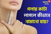 গলায় মাছের কাঁটা বিঁধে আছে? ভয় পাবেন না, ৫ উপায় ঘরেই পাবেন মুক্তি