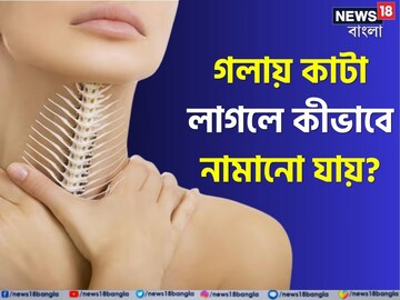 গলায় মাছের কাঁটা বিঁধে আছে? ভয় পাবেন না, ৫ উপায় ঘরেই পাবেন মুক্তি