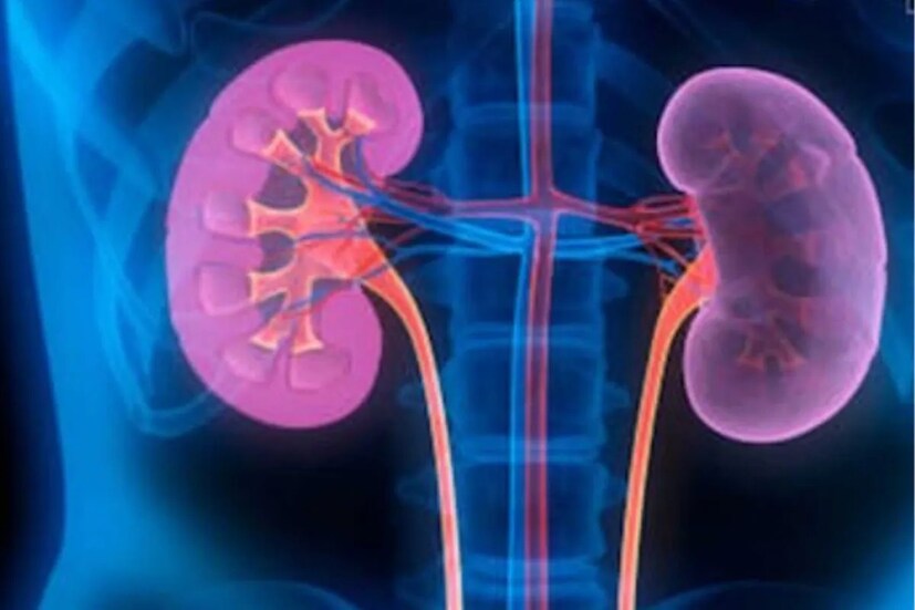 অতিরিক্ত জল খেলে কিডনিতে চাপ পড়ে৷ ফলে কিডনির সমস্যাও হতে পারে৷ কোষে অতিরিক্ত জল গেলে শরীর ফুলতে থাকে৷ মাথার কোষও ফুলতে শুরু করে৷ এমনকি ব্রেন স্ট্রোক পর্যন্ত হতে পারে৷