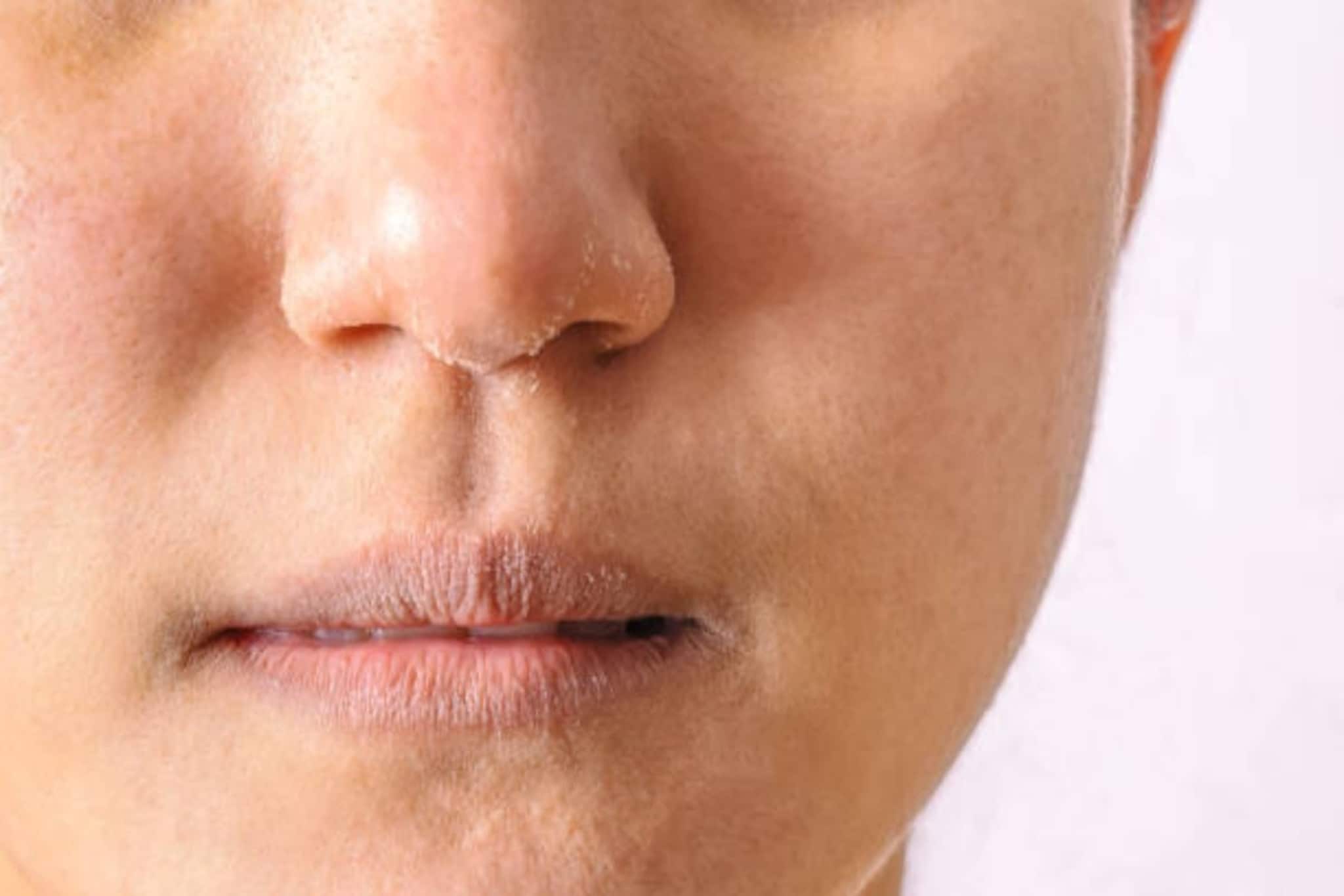 শীতেও ত্বক থাকবে টানটান, আয়নার মতো...! শুধু 'নিয়ম' মেনে করুন কয়েকটি ছোট্ট 'কাজ'