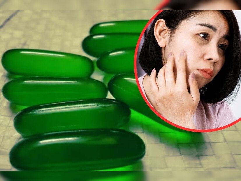 এই ক্যাপসুলটি খুব সহজেই প্রায় সব ওষুধের দোকানেই পেয়ে যাবেন। ক্যাপসুলটির দামও কিন্তু সাধ্যের মধ্যেই। এটি হল ভিটামিন ই ক্যাপসুল। নিয়ম মাফিক ভিটামিন ই ব্যবহার করলে ভাল ফল পাওয়া যায়, এই ক্যাপসুল ত্বকের বিভিন্ন ধরনের সমস্যা যেমন- ব্রণ, ফুসকুরি, দাগ ছোপ দূর করে সেই সঙ্গে ত্বকের উজ্জ্বলতা বাড়িয়ে ত্বককে করে তোলে আরও সুন্দর। এই ক্যাপসুল আমাদের ত্বককে রক্ষা করার পাশাপাশি পুষ্টিও প্রদান করে, তাই মুখের যে কোনও সমস্যার একমাত্র সলিউশন হতে পারে এই ভিটামিন ই ক্যাপসুল।