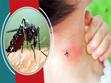মশার কামড়ে লাল দগদগে দাগ-জ্বর! ওয়েদার চেঞ্জের সময় কীভাবে বাঁচবেন? এখনই জানুন