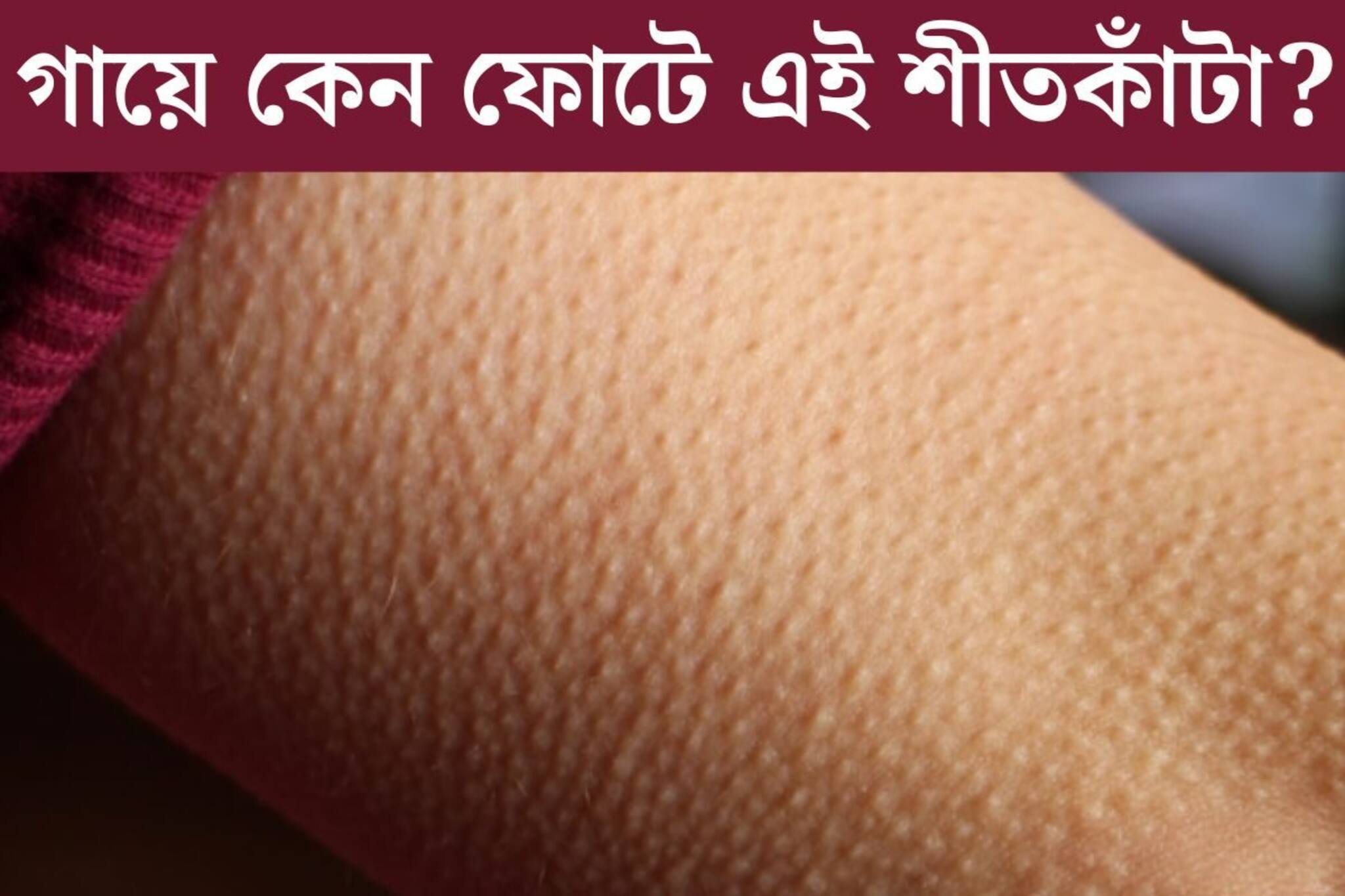 গায়ে কেন শীতকাঁটা ফোটে জানেন? সকলেরই হয়, তাও ৯৯% লোকজনই জানে না কারণ!