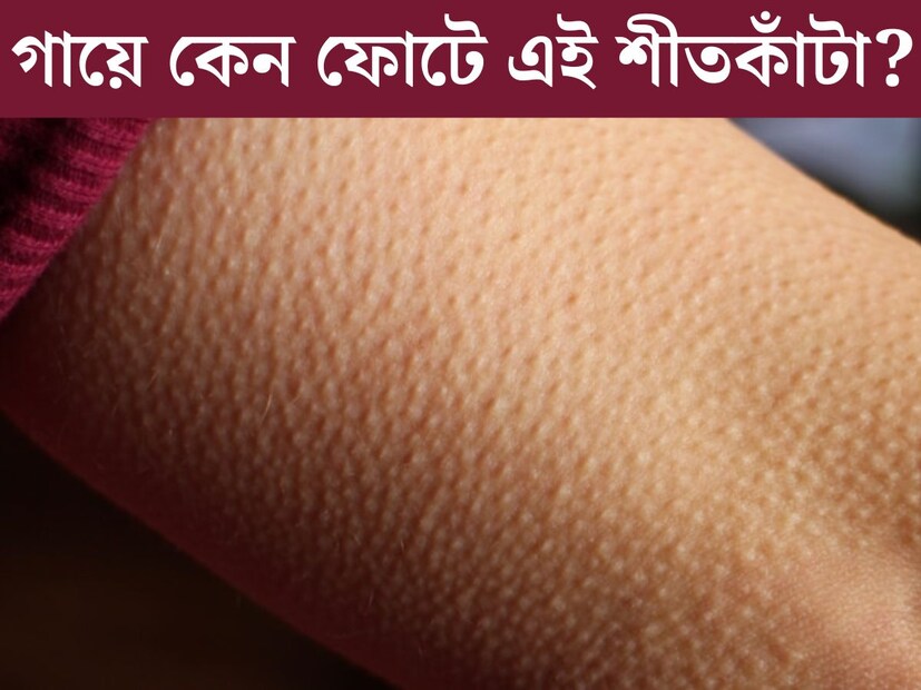 শীত করলে, ভয় পেলে এমনকী কখনও কখনও রোমহর্ষক কোনও সিনেমা দেখতেও দেখতেও গায়ের লোম খাড়া হয়ে যায়। চলতি কথায় যাকে বলা হয় গায়ে শীতকাঁটা ফুটেছে। কিন্তু এমনটা কেন হয় আসলে জানেন কী? 