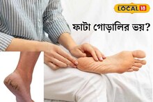 শীত এলেই ভয়, ফের ফাটবে গোড়ালি? ৫ টিপসে রাতারাতি পা হবে তুলতুলে