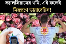 পুষ্টিতে ৪০০ টাকার অ‍্যাভোকাডোকে দশ গোল! কম দামের ফলই ডায়াবেটিসের ‘মারণাস্ত্র’