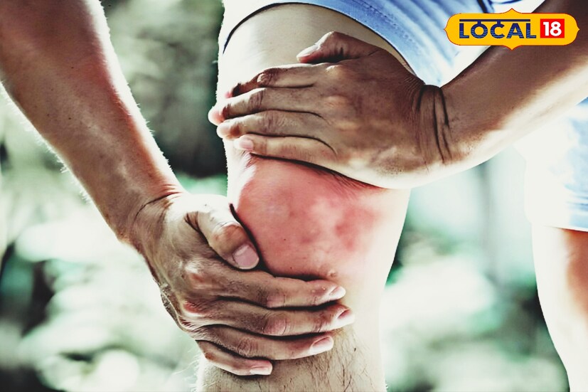 ইউরিক অ্যাসিডের মাত্রা বেড়ে গেলে শরীরে নানা সমস্যা দেখা দিতে শুরু করে বিভিন্ন সময়ে। গাঁটের ব্যথা কিংবা কিডনির সমস্যা দেখা দিলে বেশি সুযোগ ইউরিক অ্যাসিডের।