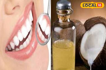 দাঁতের সমস্যা? চুল পড়ছে, ত্বক বুড়িয়ে যাচ্ছে? যৌবন ধরে রাখতে মাখুন এই তেল