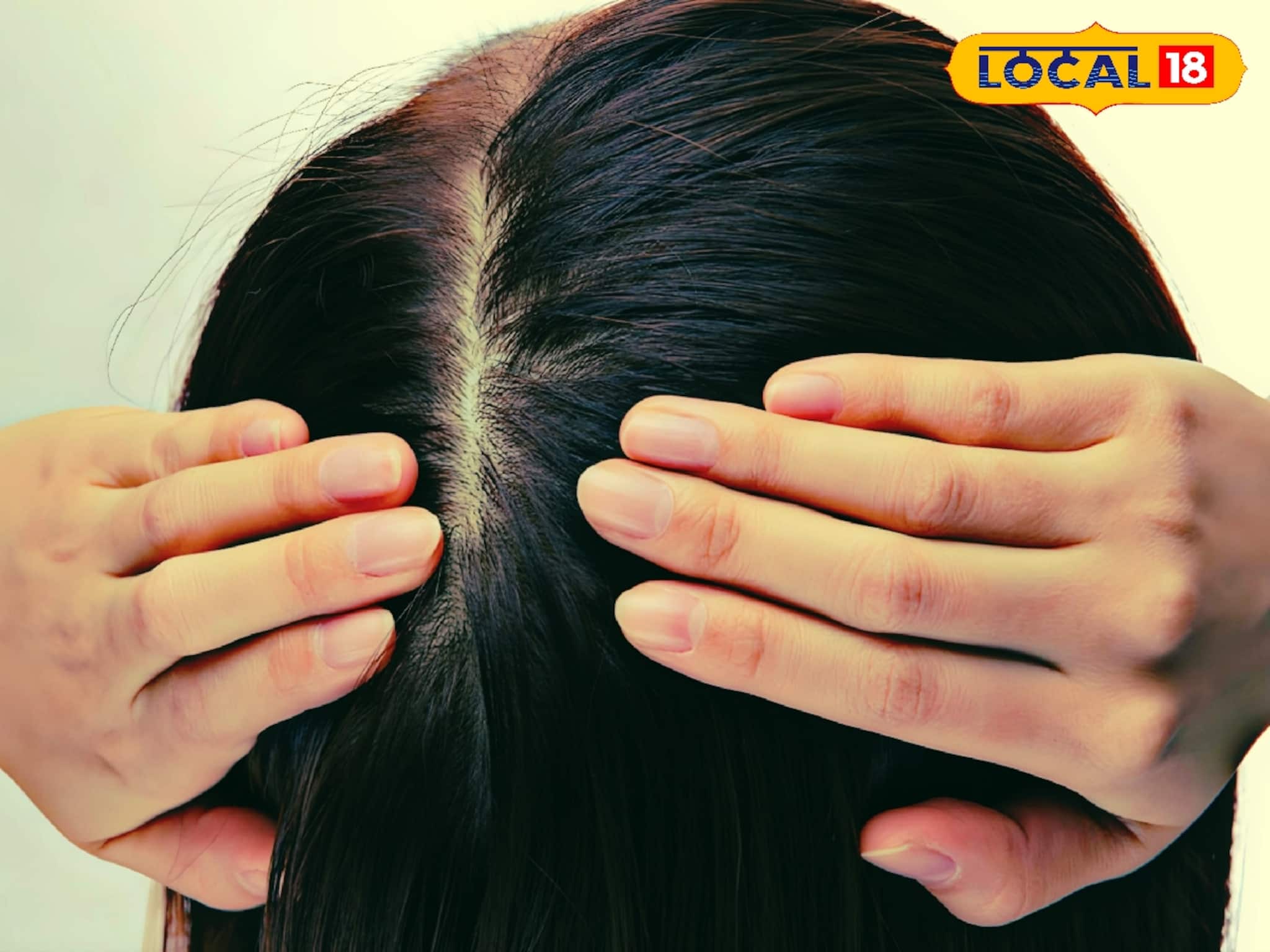 চুল খুব পাতলা? টাক দেখা যাচ্ছে? এই কৌশলে যত্ন নিলেই চুল হবে ঘন-কালো ঝলমলে!