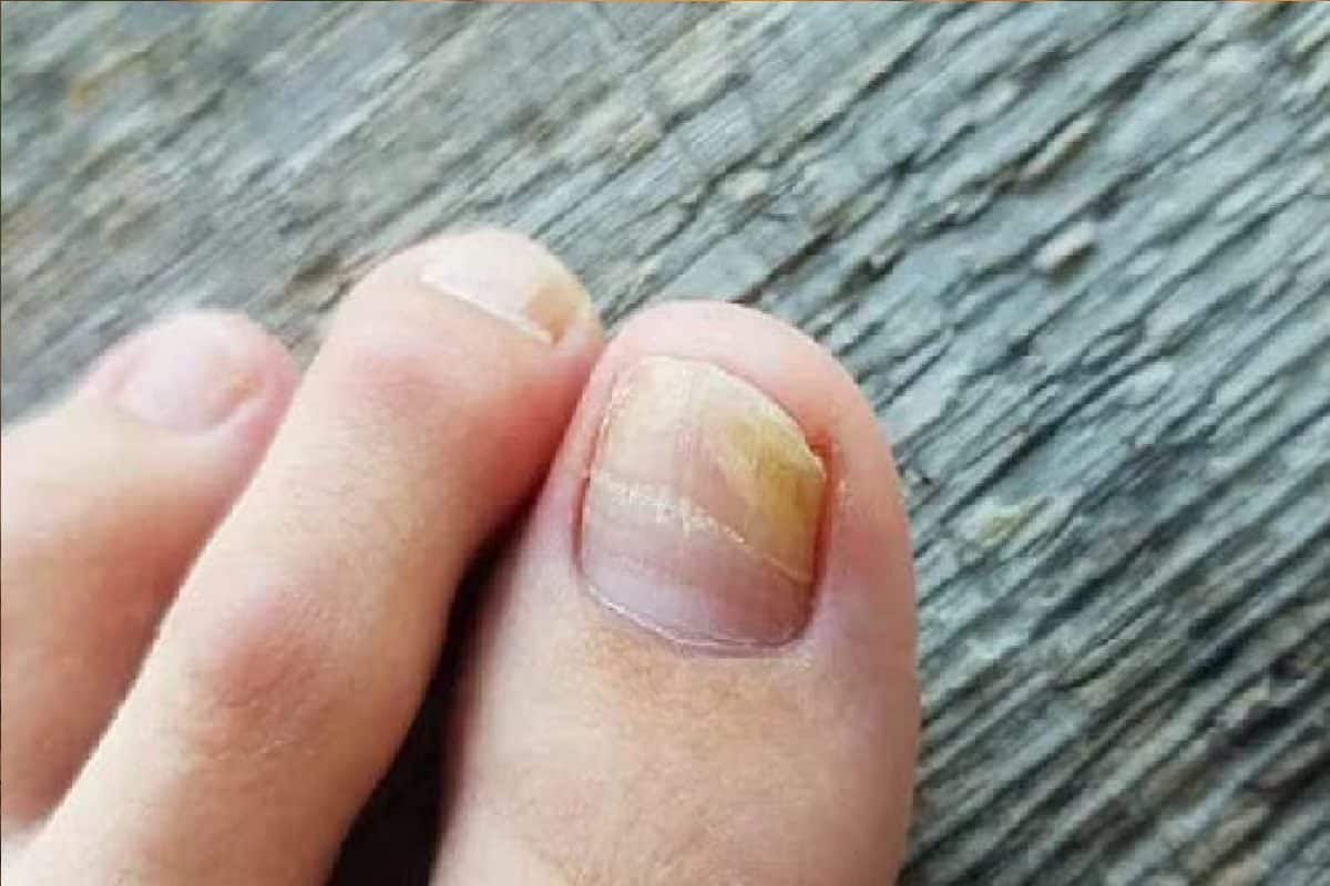 Nail Health Issue: আপনার নখের রঙ কি বদলে যাচ্ছে, অজান্তেই শরীরে বাসা বাঁধছে মারণ রোগ! এখনই জানুন আপনি সুস্থ না অসুস্থ… Nail Health Issue: আপনার নখের রঙ কি বদলে যাচ্ছে, অজান্তেই শরীরে বাসা বাঁধছে মারণ রোগ! এখনই জানুন আপনি সুস্থ না অসুস্থ…