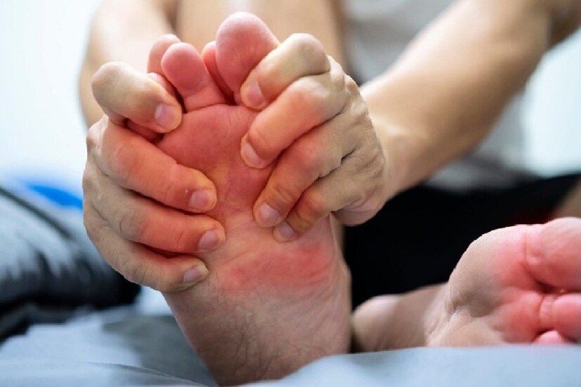 ইউরিক অ্যাসিড-এর ব্যথা থেকে বাঁচতে হলে অবশ্যই ডাক্তারের সঙ্গে পরামর্শ করতে হবে৷ খাওয়ার সময় ডায়েটে মেনে চলতে হবে, সঙ্গে খেতে হবে প্রচুর জল৷ বেশি করে জল খেলে ইউরিক অ্যাসিড প্রসাব দিয়ে বেড়িয়ে যায়৷