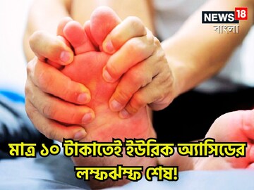 সামান্য টাকায় ইউরিক অ্যাসিড নিংড়ে নেবে, গাঁটে গাঁটে ব্যথা যন্ত্রণার দিন শেষ